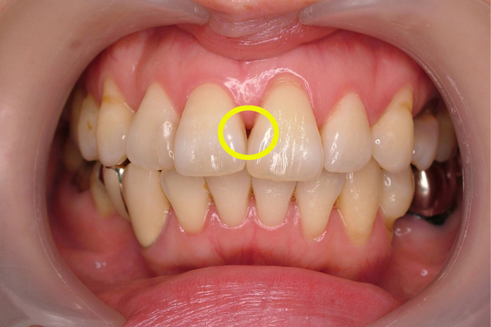 九段下スターデンタル 歯並び矯正治療
