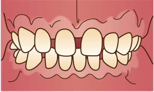 orthodontics034