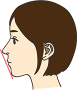 出っ歯を直すと横顔の印象も変わりますか？