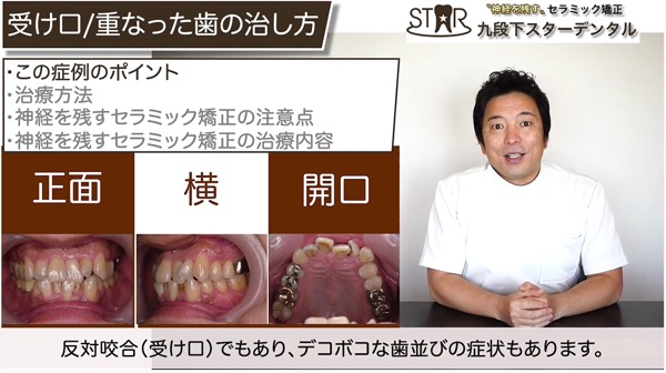 治療前の歯の特徴