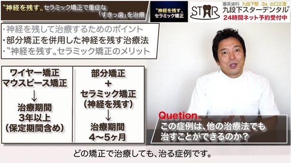 〝神経を残す〟セラミック矯正以外の治療法