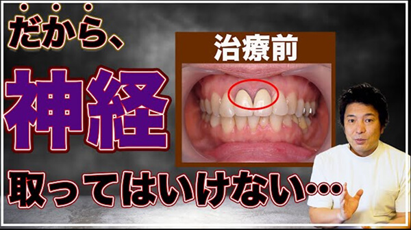 歯ぐきの黒ずみの原因と治療法について解説します。