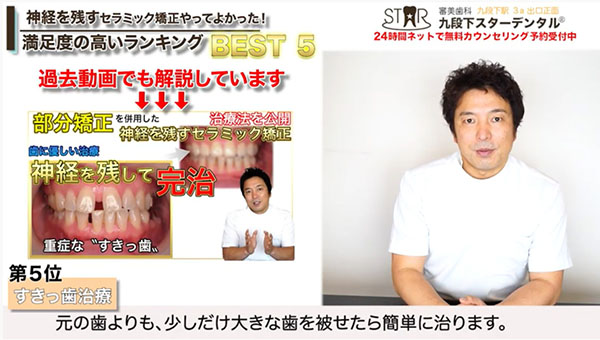 第5位 すきっ歯の人