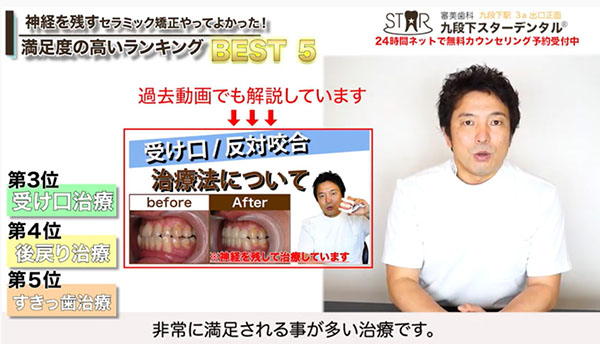 第3位 受け口の人
