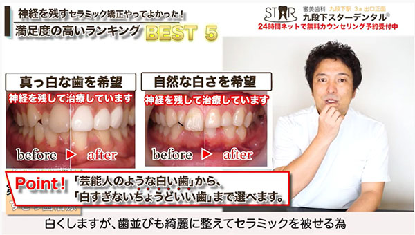 第2位 歯を白くしたい人