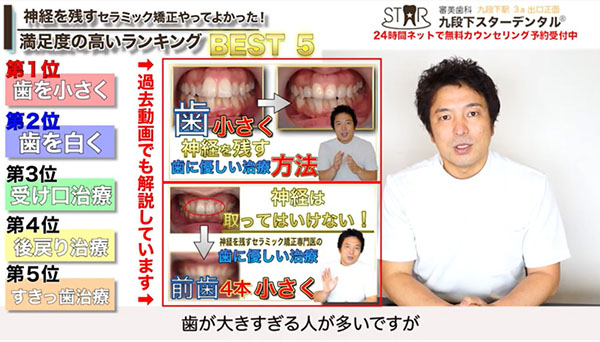 第1位 歯を小さくしたい人