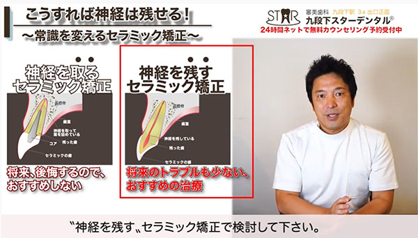 セラミック矯正と〝神経を残す〟セラミック矯正は別物