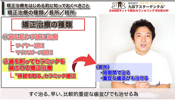 〝神経を残す〟セラミック矯正に向いている人