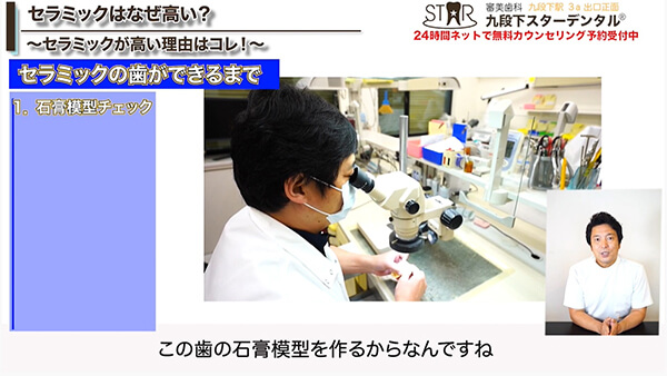 1．石膏模型チェック