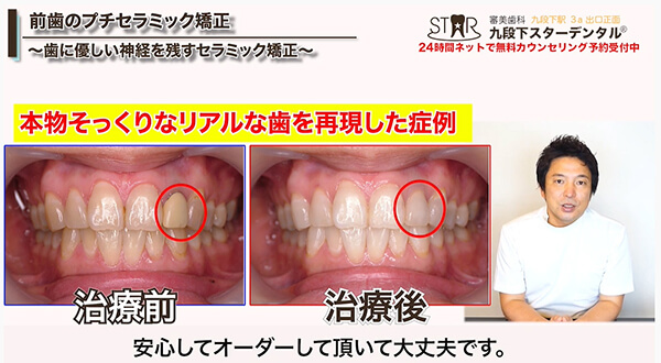 本物そっくりな白さにもできる