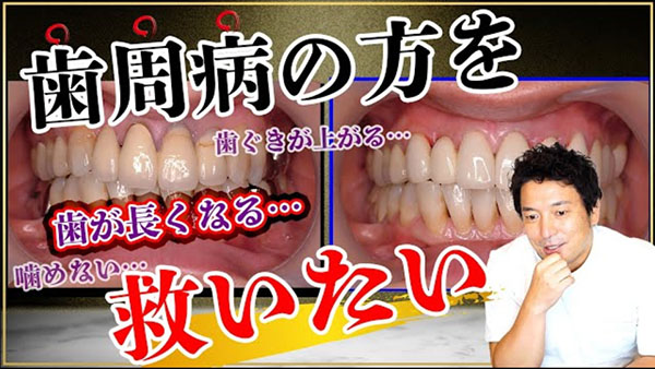 歯周病でもキレイな歯並びを取り戻す方法をご紹介します。