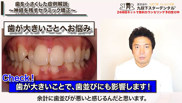 日本人の歯の特徴