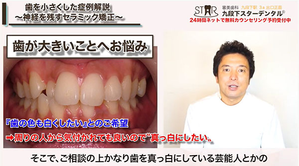 患者さんの希望②：「歯を白くしたい」