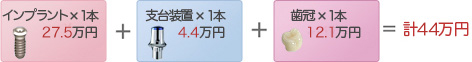 インプラント治療費