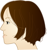 受け口のデメリット
