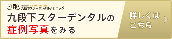 九段下スターデンタルの症例写真を見る